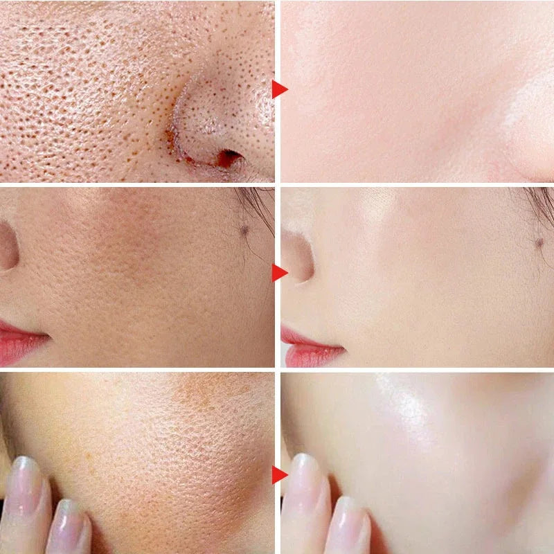 Facial Redness Repair Cream Improve Sensitive Skin Dryness Moisturizer Hydrating Sooth Lotion Removal Rosacea Korean Cosmetics