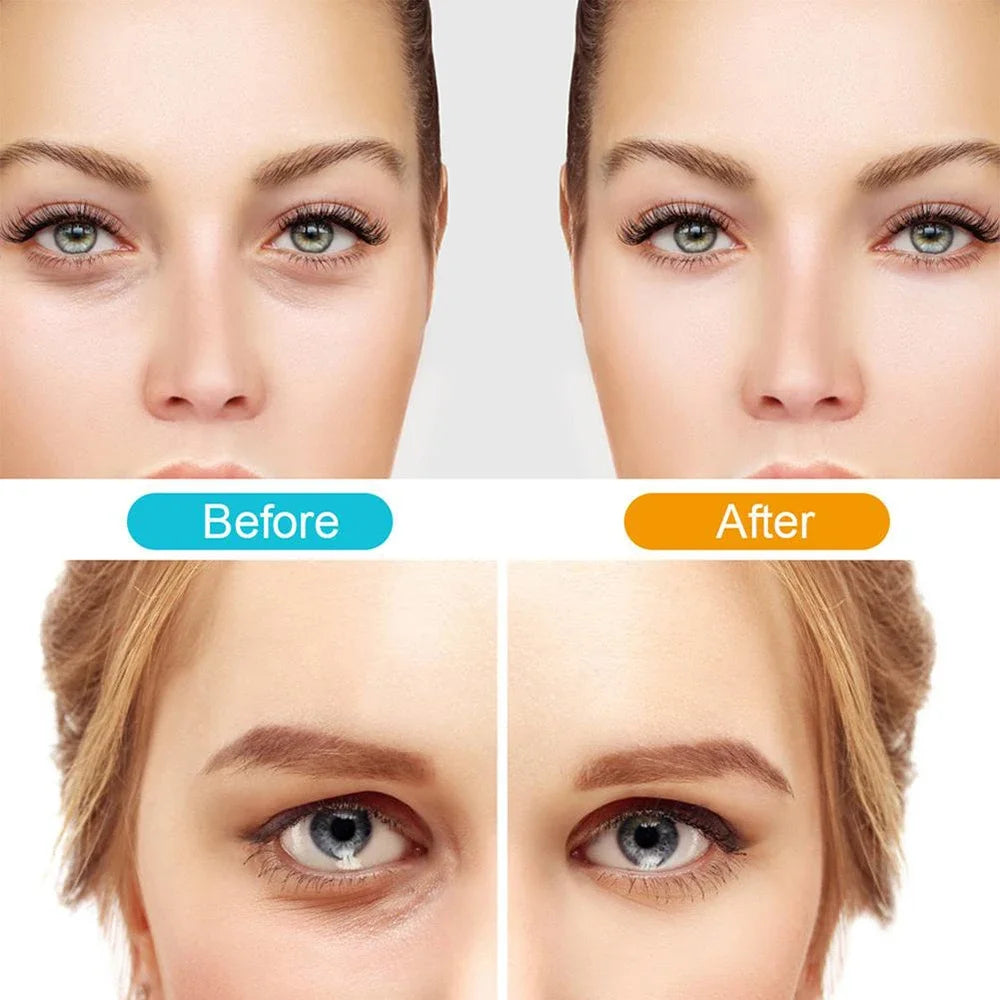 Anti-Aging Eye Massager Eyes Fatigue Relief Relaxation Relieve EMS Eye Massage Dark Circles Eye Bag Removal EyeCare Beauty Tools