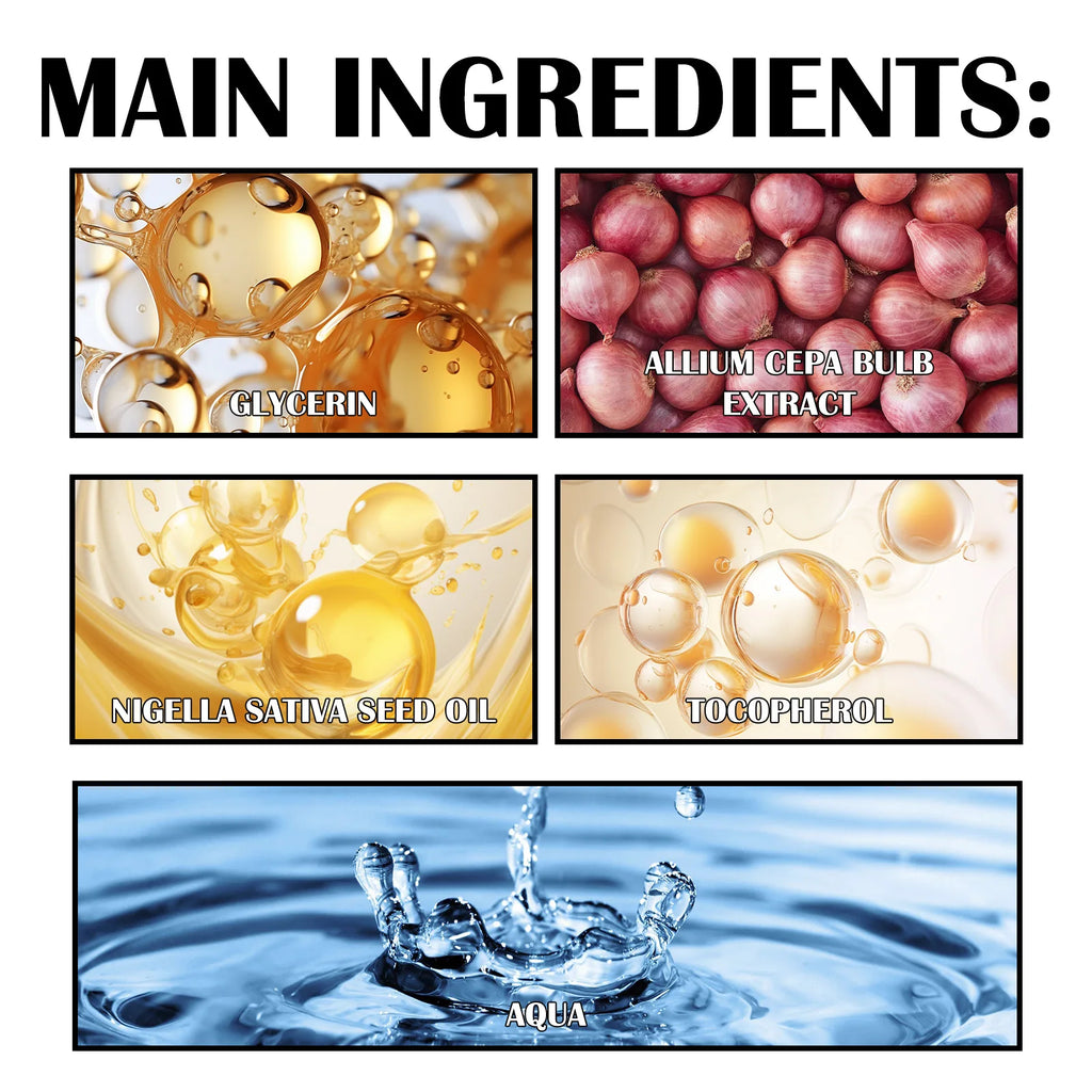 Eelhoe Red Onion Shampoo Black Seed Oil Hair Care Shampoo Hair Care Cleansing Scalp Refreshing Shampoo Hair Care Oil