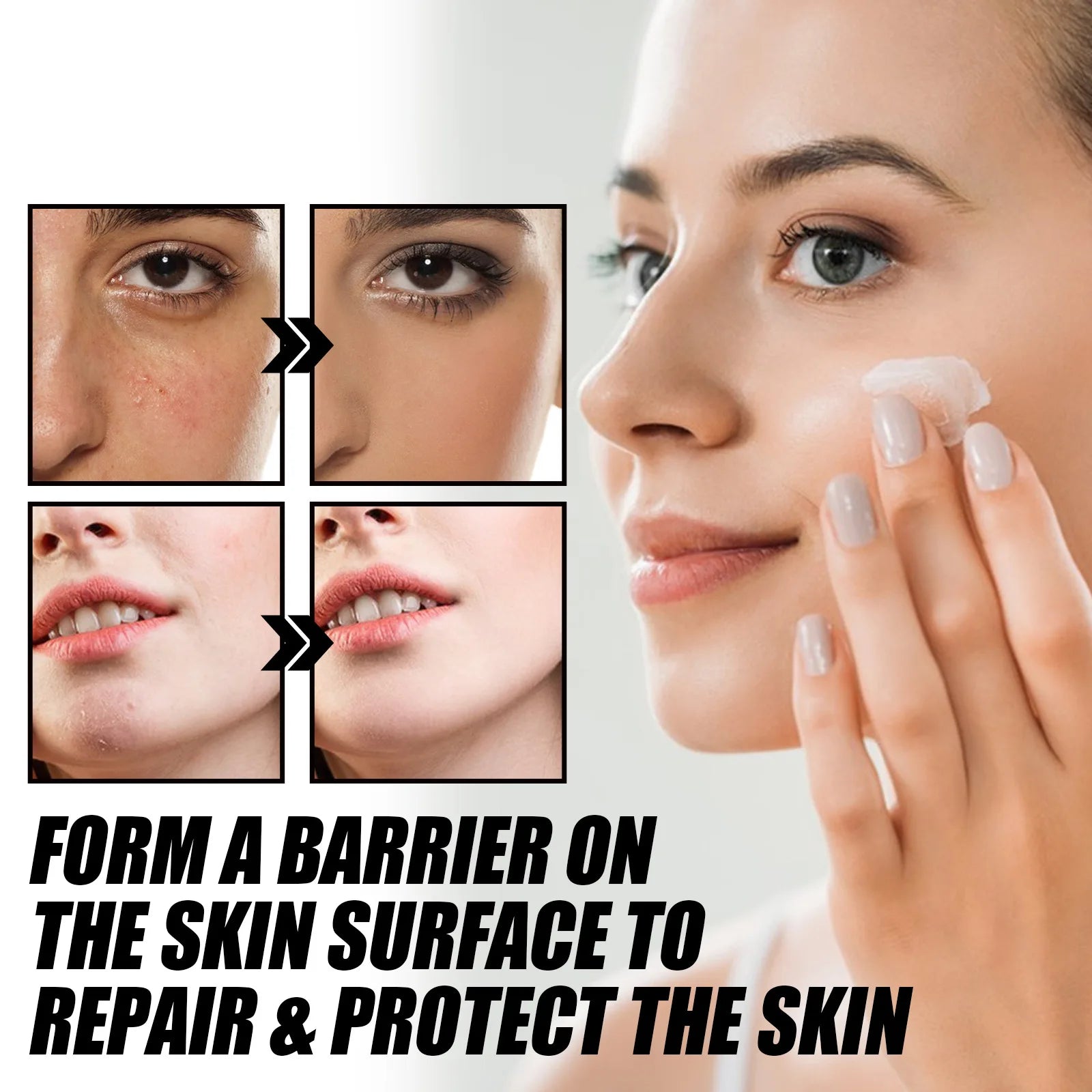 Facial Redness Repair Cream Improve Sensitive Skin Dryness Moisturizer Hydrating Sooth Lotion Removal Rosacea Korean Cosmetics
