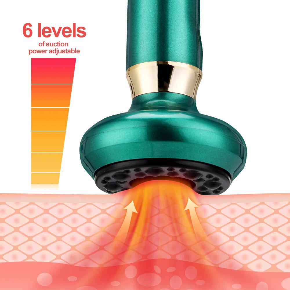 Chinese Electric Suction Vacuum Cupping Anti Cellulite Beauty Massager Glass Jars Anti Cellulite Cupping Vacuum Slimming Guasha