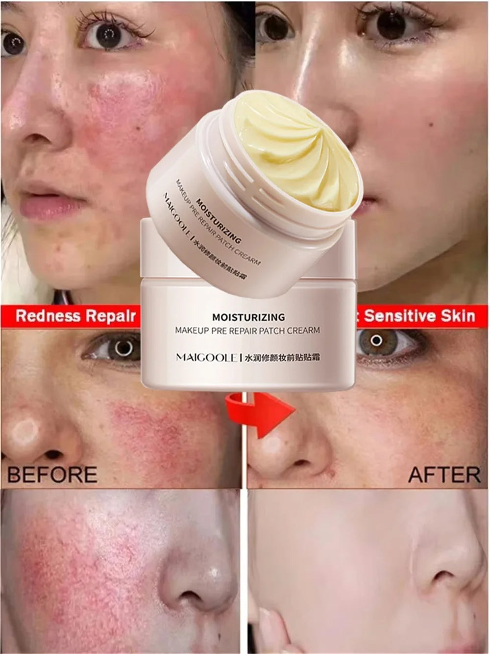 Facial Redness Repair Cream Improve Sensitive Skin Dryness Moisturizer Hydrating Sooth Lotion Removal Rosacea Korean Cosmetics