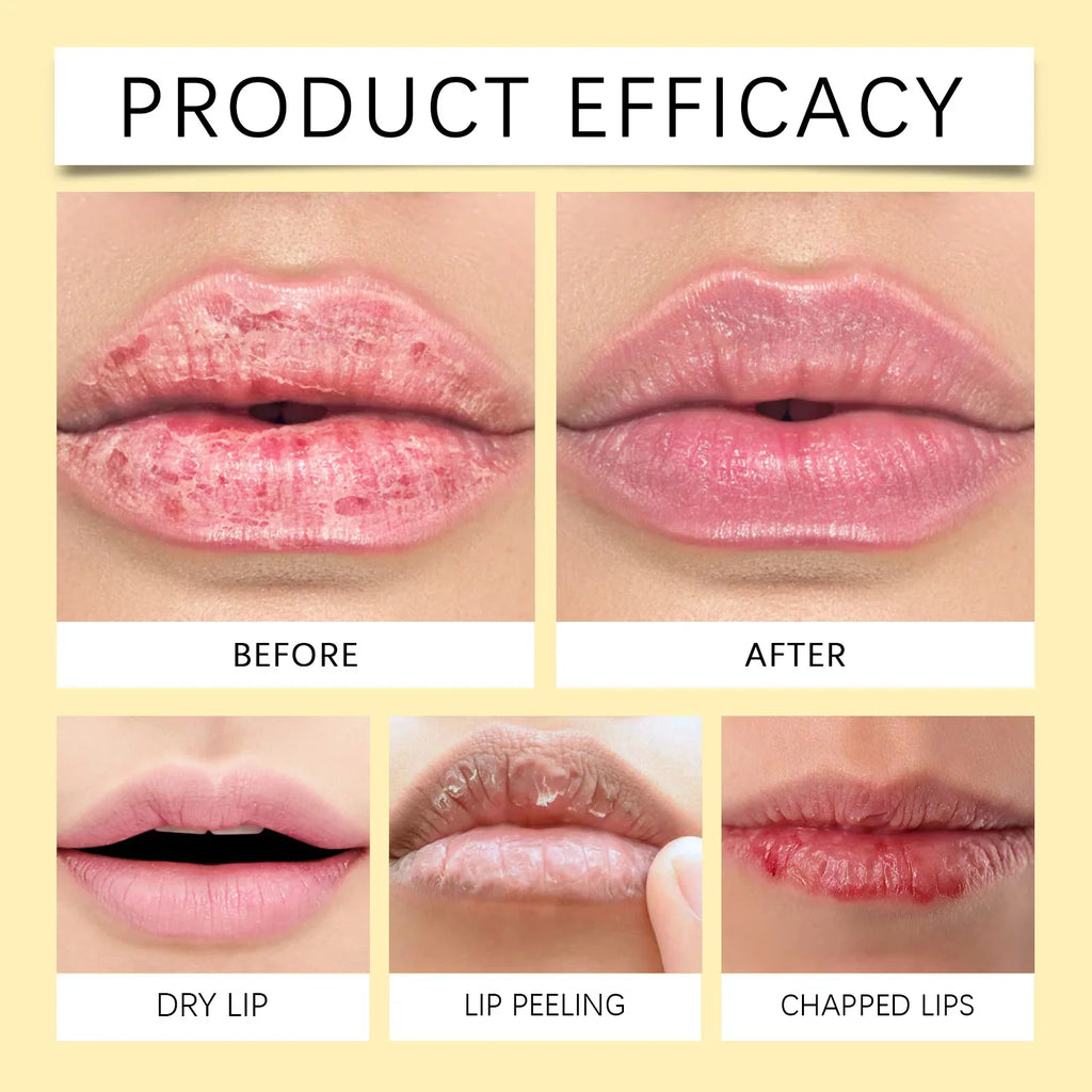 Remove Dark Lip Balm Lightening Melanin Mask Gloss Oil Exfoliating Clean Moisturizer Korean Care Makeup Beauty Health Products